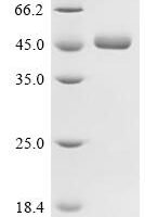 Human Interleukin-2 (IL2), Biotinylated Recombinant Protein - BioCrest Sci