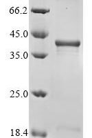 Human Survival motor neuron protein (SMN1) Recombinant Protein - BioCrest Sci