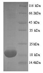 Mouse Major urinary protein 2 (Mup2) Recombinant Protein, N-His, aa 19–180, Yeast, Mus musculus (Mouse), Yeast, N-terminal 6xHis-tagged, 20.7 kDa, purity >≥ 90% as determined by SDS-PAGE.