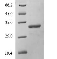 Mouse DNA-dependent protein kinase catalytic subunit (Prkdc), partial Recombinant Protein - BioCrest Sci