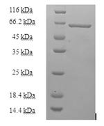 Human Heterogeneous nuclear ribonucleoprotein H (HNRNPH1) Recombinant Protein - BioCrest Sci