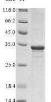 Vesicular stomatitis Indiana virus Matrix protein (M) Recombinant Protein, N-His, aa 1–237, E.coli - BioCrest Sci