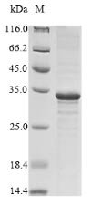 Vesicular stomatitis Indiana virus Matrix protein (M) Recombinant Protein, N-His, aa 1–237, E.coli, Vesicular stomatitis Indiana virus (strain Glasgow) (VSIV), E.coli, N-terminal 6xHis-tagged, 30.8 kDa, purity >≥ 85% as determined by SDS-PAGE.