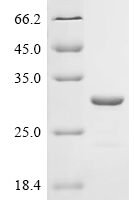 Klebsiella pneumoniae Outer-membrane lipoprotein carrier protein (lolA) Recombinant Protein - BioCrest Sci