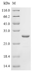 Klebsiella pneumoniae Outer-membrane lipoprotein carrier protein (lolA) Recombinant Protein, Klebsiella pneumoniae (strain 342), E.coli, C-terminal 6xHis-tagged, 27.3 kDa, purity >≥ 90% as determined by SDS-PAGE.