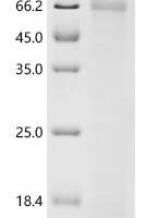 Pongo abelii Dyslexia-associated protein KIAA0319-like protein (KIAA0319L), partial Recombinant Protein, C-His, aa 310–785, Yeast - BioCrest Sci