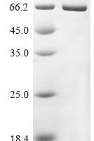 Chicken Lysozyme g, Biotinylated Recombinant Protein - BioCrest Sci