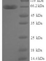 Human Zinc finger protein 114 (ZNF114), partial Recombinant Protein - BioCrest Sci