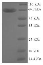 Human Zinc finger protein 114 (ZNF114), partial Recombinant Protein, Homo sapiens (Human), E.coli, N-terminal 6xHis-SUMO-tagged, 63.4 kDa, purity >≥ 90% as determined by SDS-PAGE.