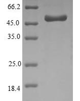 Haemophilus influenzae Outer membrane protein P5 (ompA) Recombinant Protein - BioCrest Sci