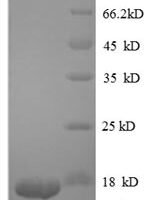 Human Transforming growth factor beta-1 proprotein (TGFB1), partial Recombinant Protein - BioCrest Sci