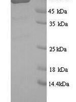 Human GRB10-interacting GYF protein 2 (GIGYF2), partial Recombinant Protein, N-His, aa 510–1030, Yeast - BioCrest Sci