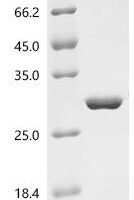 Escherichia coli O157:H7 FMN-dependent NADH:quinone oxidoreductase (azoR) Recombinant Protein - BioCrest Sci