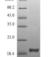 Mouse 3-hydroxy-3-methylglutaryl-coenzyme A reductase (Hmgcr), partial Recombinant Protein - BioCrest Sci