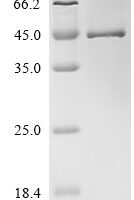 Human Lipoyltransferase 1, mitochondrial (LIPT1) Recombinant Protein, C-His - BioCrest Sci
