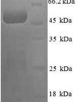 Human COP9 signalosome complex subunit 7a (COPS7A) Recombinant Protein - BioCrest Sci