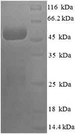 Human COP9 signalosome complex subunit 7a (COPS7A) Recombinant Protein, Homo sapiens (Human), E.coli, N-terminal 6xHis-SUMO-tagged, 46.1 kDa, purity >≥ 90% as determined by SDS-PAGE.