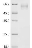 Human Glucagon-like peptide 2 receptor (GLP2R), partial, Biotinylated Recombinant Protein - BioCrest Sci