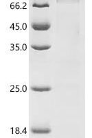 Mouse Serine/threonine-protein kinase Nek5 (Nek5) Recombinant Protein - BioCrest Sci