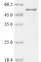 Mouse Phosphorylated adapter RNA export protein (Phax) Recombinant Protein - BioCrest Sci