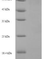 Scytonema varium Scytovirin Recombinant Protein - BioCrest Sci