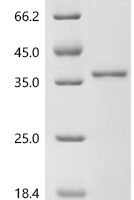 Rat Insulin-1（Ins1) Recombinant Protein - BioCrest Sci