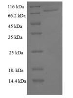 Human Peroxisome proliferator-activated receptor gamma (PPARG) Recombinant Protein, N-His-SUMO - BioCrest Sci