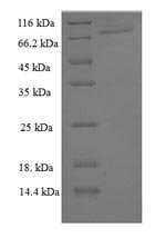 Human Peroxisome proliferator-activated receptor gamma (PPARG) Recombinant Protein, N-His-SUMO, Homo sapiens (Human), E.coli, N-terminal 6xHis-SUMO-tagged, 70.3 kDa, purity >≥ 90% as determined by SDS-PAGE.