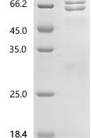 Human Fibrinogen beta chain (FGB) Recombinant Protein, N-His-PDI - BioCrest Sci