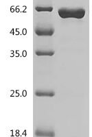 Mouse Nicotinamide phosphoribosyltransferase (Nampt) Recombinant Protein, N-His - BioCrest Sci