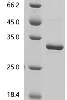 Mouse Cytochrome c1, heme protein, mitochondrial (Cyc1), partial Recombinant Protein, N-His - BioCrest Sci