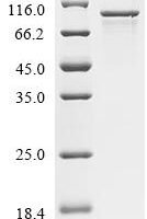 Human Probable ATP-dependent RNA helicase DDX4 (DDX4) Recombinant Protein - BioCrest Sci