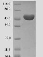 Human Ameloblastin (AMBN) Recombinant Protein - BioCrest Sci