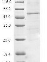 Human Mitochondrial import inner membrane translocase subunit Tim21 (TIMM21) Recombinant Protein - BioCrest Sci