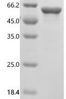 Human Peripherin (PRPH) Recombinant Protein, N-His - BioCrest Sci