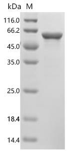 Human Peripherin (PRPH) Recombinant Protein, N-His, Homo sapiens (Human), E.coli, N-terminal 6xHis-tagged, 57.7 kDa, purity >≥ 90% as determined by SDS-PAGE.