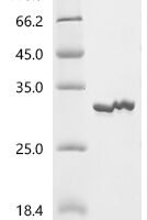 Thermotoga neapolitana Endonuclease V (nfi) Recombinant Protein, N-10His/C-Myc - BioCrest Sci
