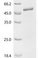 Human Ryanodine receptor 1 (RYR1), partial Recombinant Protein, C-His - BioCrest Sci