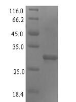 Human DNA repair protein complementing XP-G cells (ERCC5), partial Recombinant Protein - BioCrest Sci