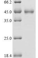 Human SH3 and multiple ankyrin repeat domains protein 3 (SHANK3), partial Recombinant Protein, C-hFc1 - BioCrest Sci