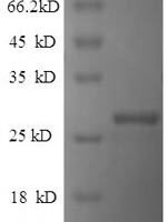 Human Indian hedgehog protein (IHH) Recombinant Protein - BioCrest Sci