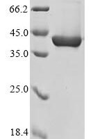 Mouse Chitinase-3-like protein 4 (Chi3l4) Recombinant Protein - BioCrest Sci