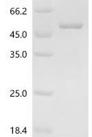 Human Oxysterol-binding protein 1 (OSBP), partial Recombinant Protein - BioCrest Sci