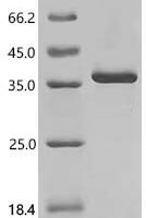 Mouse Meteorin-like protein (Metrnl) Recombinant Protein, C-His - BioCrest Sci
