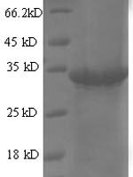 Escherichia phage T7 Single-stranded DNA-binding protein (2.5) Recombinant Protein - BioCrest Sci