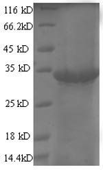 Escherichia phage T7 Single-stranded DNA-binding protein (2.5) Recombinant Protein, Escherichia phage T7 (Bacteriophage T7), E.coli, N-terminal 6xHis-SUMO-tagged, 41.9 kDa, purity >≥ 90% as determined by SDS-PAGE.