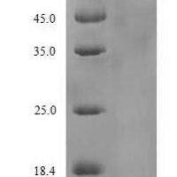 Influenza A virus Hemagglutinin (HA), partial Recombinant Protein, N-His-SUMO, aa 19–524 - BioCrest Sci