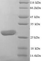 Human Leukocyte immunoglobulin-like receptor subfamily A member 5 (LILRA5), partial Recombinant Protein, N-His, aa 42–268, Yeast, Homo sapiens (Human), Yeast, N-terminal 6xHis-tagged, 27.2 kDa, purity >≥ 90% as determined by SDS-PAGE.
