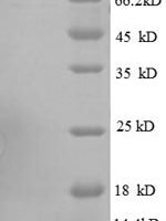 Escherichia coli 30S ribosomal protein S19 (rpsS) Recombinant Protein - BioCrest Sci
