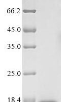 Bordetella bronchiseptica Azurin (BB3856) Recombinant Protein, N-His - BioCrest Sci
